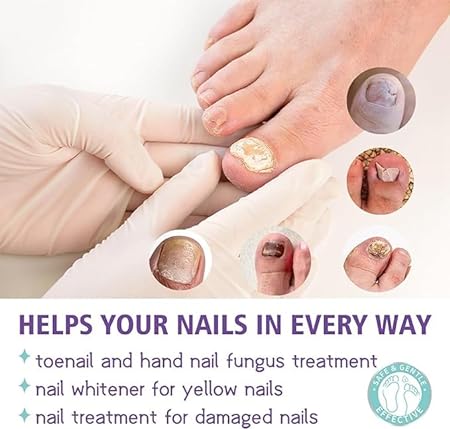 Nail Treatment for Toenails